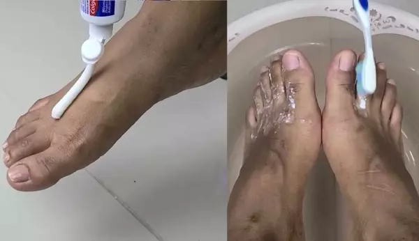 Dlaczego warto smarować pięty pastą do zębów: zaskakujący powód ➤ haberion.com